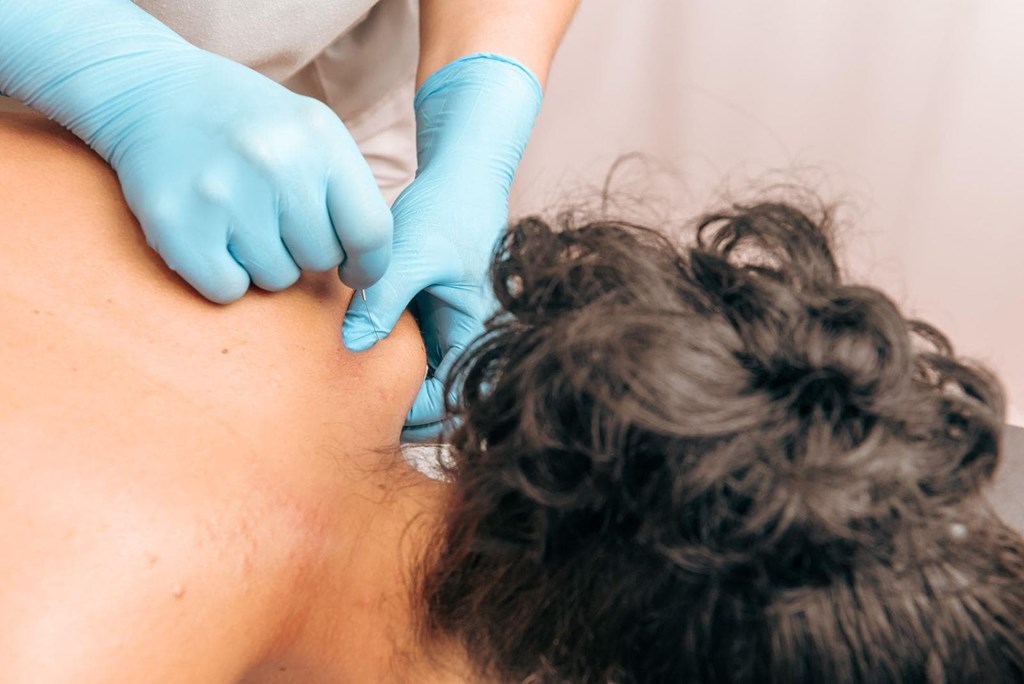 ¿En qué consiste nuestra técnica de fisioterapia no invasiva en O Porriño?