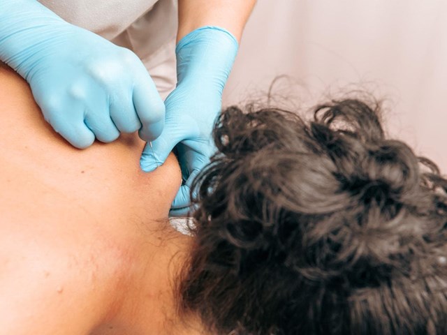 ¿En qué consiste nuestra técnica de fisioterapia no invasiva en O Porriño?
